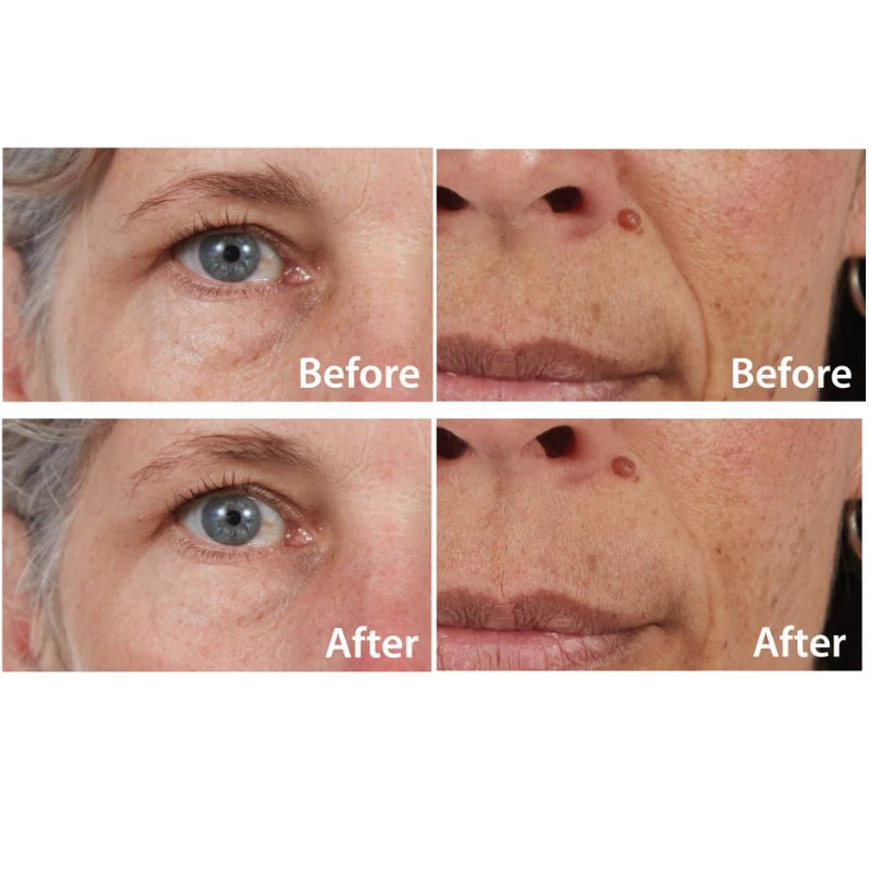 5in1 Facial Solution - Professional Facial Mask - Image 5