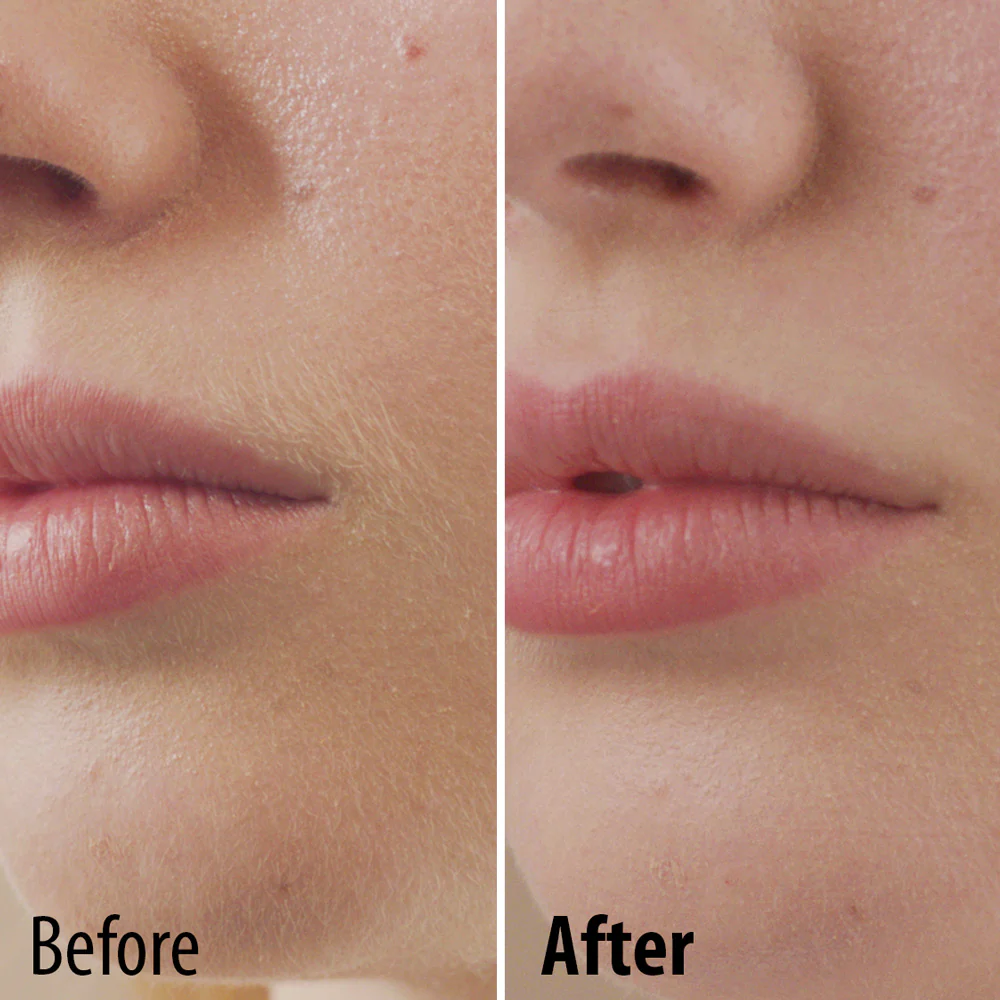 Perfect Face Facial Hair Remover - Image 3