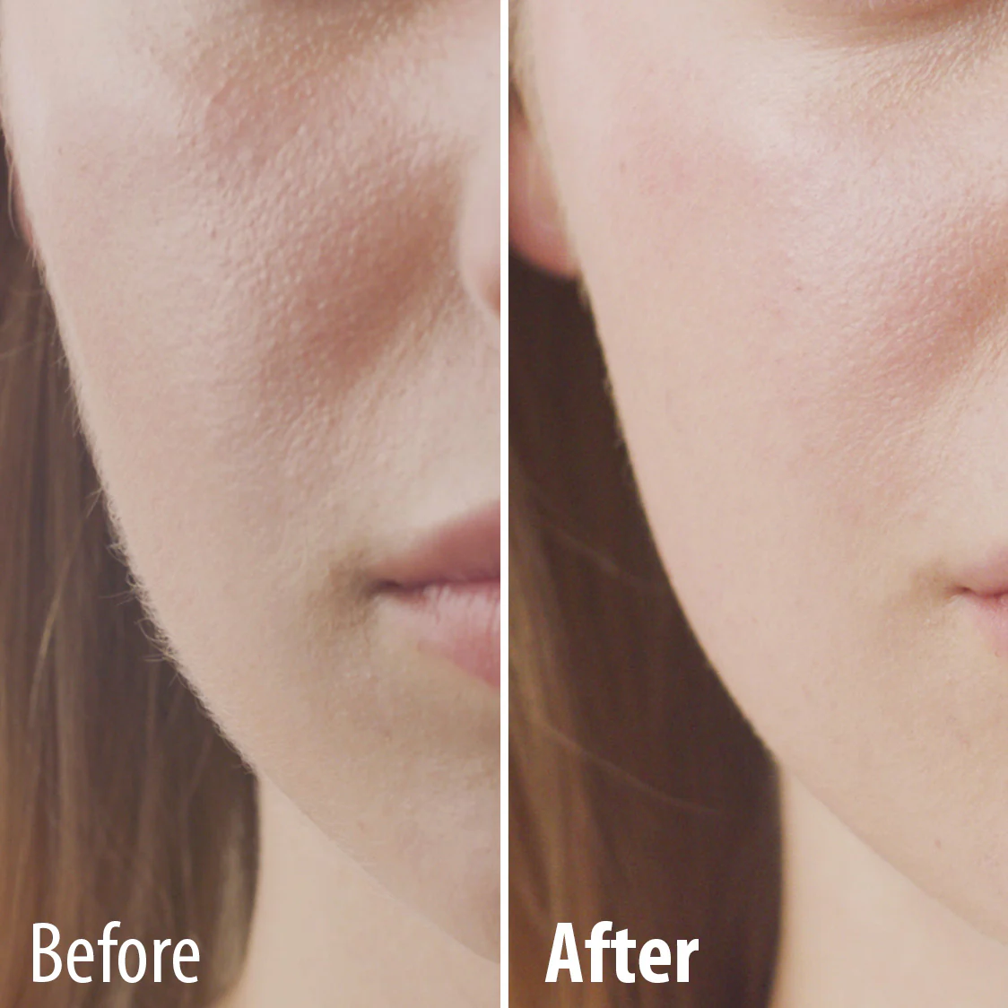 Perfect Face Facial Hair Remover - Image 4