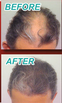 Power Grow Max by Velform - Image 3