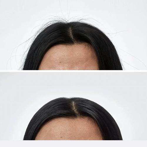 Smooth Hair Wand - Image 3