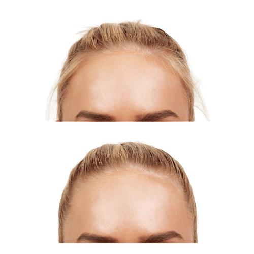 Smooth Hair Wand - Image 4